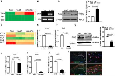 Sonic Hedgehog Induces Mesenchymal Stromal Cell Senescence-Associated Secretory Phenotype and Chondrocyte Apoptosis in Human Osteoarthritic Cartilage